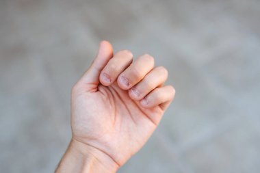 Tırnakları yenmiş ve çirkin bir adamın eli. Ellere kötü bakılıyor