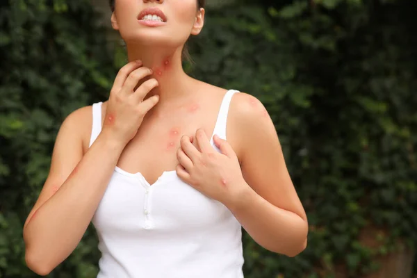 Mujer Rascarse Cuello Con Picaduras Insectos Parque Primer Plano — Foto de Stock