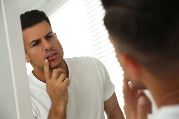 Homem Com Herpes Tocando Lábios Frente Espelho Casa — Fotografia de Stock