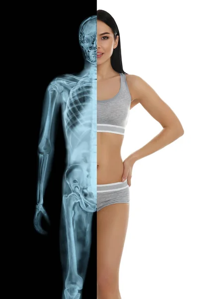 Çamaşırlı Kadın Yarı Röntgenli Fotoğraf Tıbbi Kontrol — Stok fotoğraf