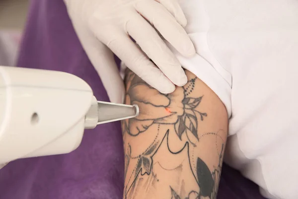 Young woman undergoing laser tattoo removal procedure in salon, closeup