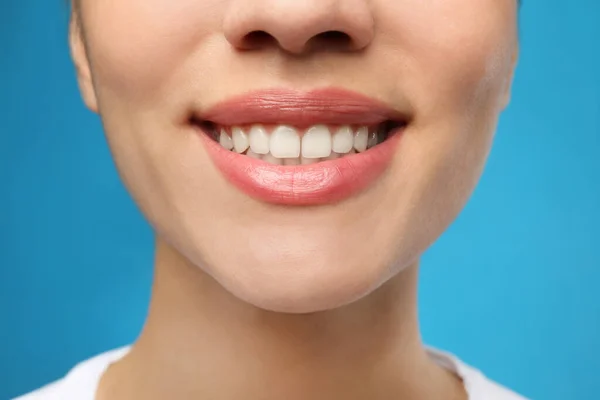 Kobieta Zdrowymi Zębami Pięknym Uśmiechem Niebieskim Tle Zbliżenie Stomatologia Kosmetyczna — Zdjęcie stockowe