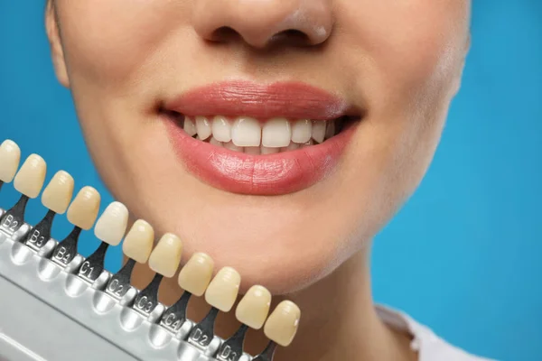 Kobieta Sprawdzająca Kolor Zębów Niebieskim Tle Zbliżenie Stomatologia Kosmetyczna — Zdjęcie stockowe