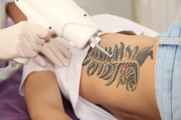 Νεαρή Γυναίκα Υποβάλλεται Διαδικασία Αφαίρεσης Τατουάζ Λέιζερ Στο Σαλόνι Κοντινό — Φωτογραφία Αρχείου