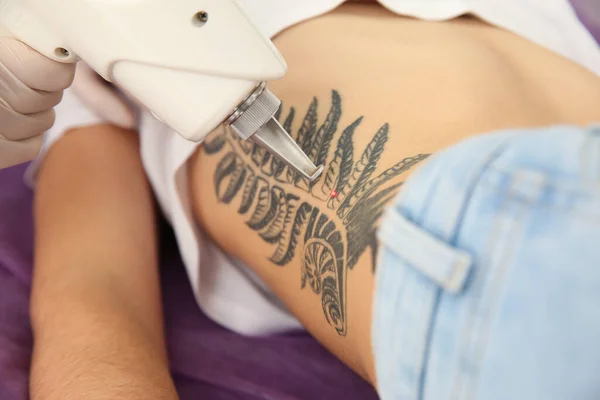 Young woman undergoing laser tattoo removal procedure in salon, closeup