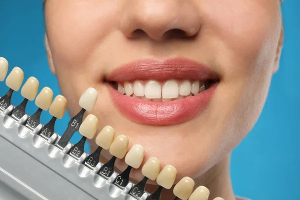 Жінка Перевіряє Колір Зубів Синьому Фоні Крупним Планом Косметична Стоматологія — стокове фото