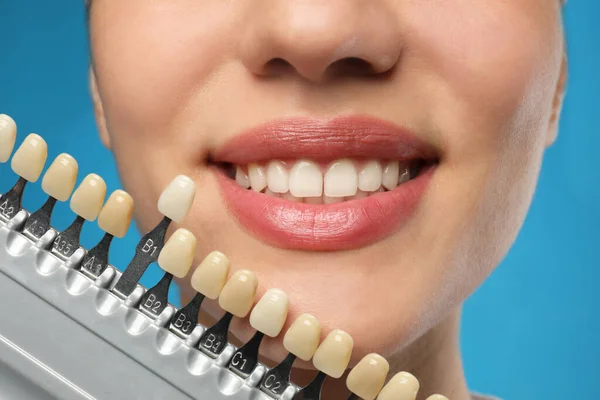 Mujer Comprobando Color Sus Dientes Sobre Fondo Azul Primer Plano — Foto de Stock