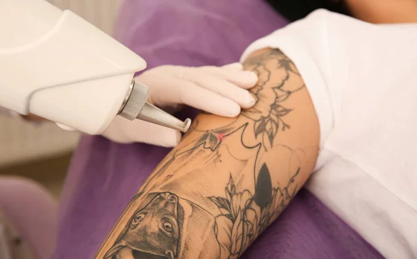 Młoda Kobieta Poddana Zabiegowi Laserowego Usuwania Tatuaży Salonie Zbliżenie — Zdjęcie stockowe
