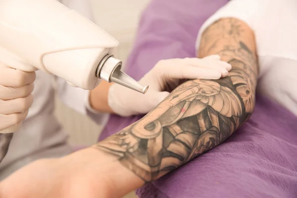 Mujer Joven Sometida Procedimiento Eliminación Tatuajes Láser Salón Primer Plano — Foto de Stock
