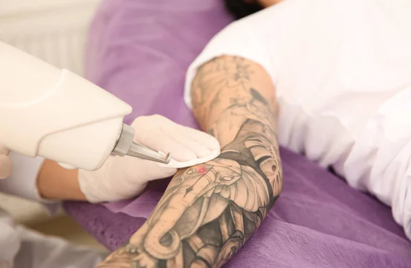 Giovane Donna Sottoposta Procedura Rimozione Del Tatuaggio Laser Salone Primo — Foto Stock