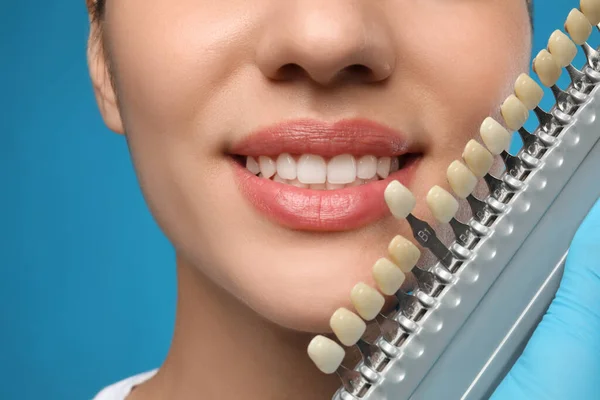 Docteur Vérifiant Couleur Des Dents Jeune Femme Sur Fond Bleu — Photo