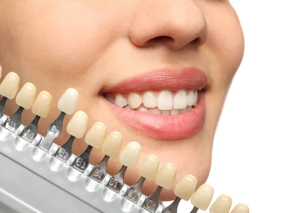 Woman Checking Her Teeth Color White Background Closeup Cosmetic Dentistry — Stock Photo, Image