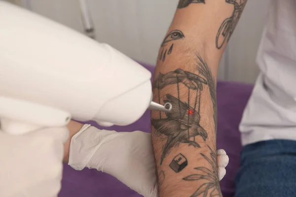 Hombre Joven Sometido Procedimiento Eliminación Tatuajes Láser Salón Primer Plano — Foto de Stock