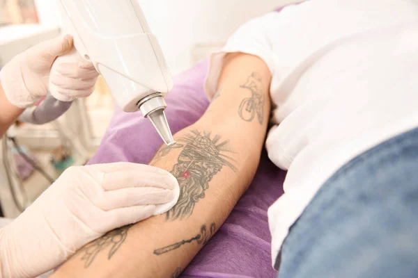 Młody Mężczyzna Poddany Zabiegowi Laserowego Usuwania Tatuaży Salonie Zbliżenie — Zdjęcie stockowe
