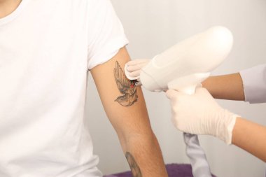 Genç adam kuaförde lazer dövme silme prosedürü uyguluyor, yakın plan.