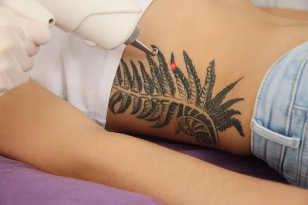 Junge Frau Unterzieht Sich Laser Tattooentfernung Salon Nahaufnahme — Stockfoto