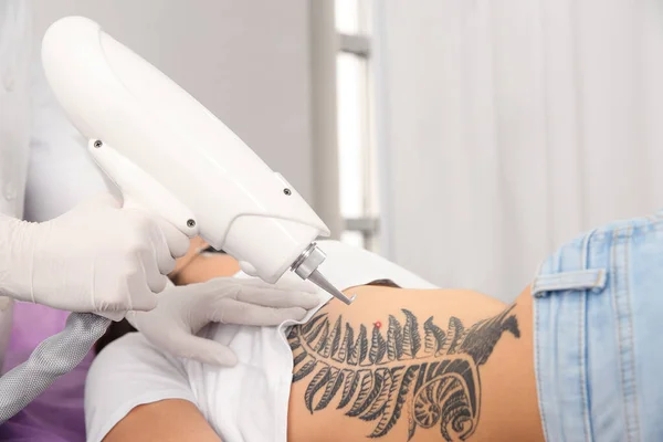 Mujer Joven Sometida Procedimiento Eliminación Tatuajes Láser Salón Primer Plano — Foto de Stock