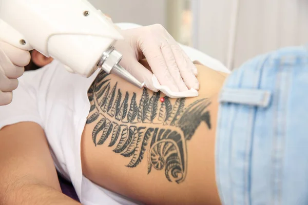 Mujer Joven Sometida Procedimiento Eliminación Tatuajes Láser Salón Primer Plano — Foto de Stock