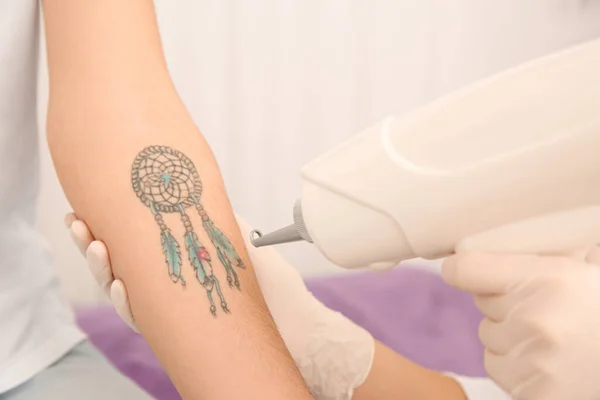 Mujer Joven Sometida Procedimiento Eliminación Tatuajes Láser Salón Primer Plano — Foto de Stock