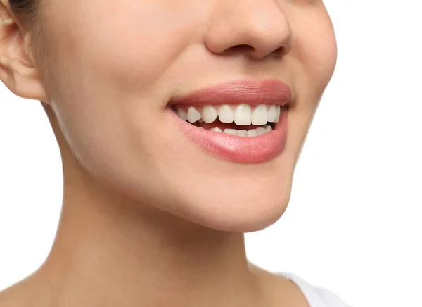 Mulher Com Dentes Saudáveis Belo Sorriso Fundo Branco Close Odontologia — Fotografia de Stock