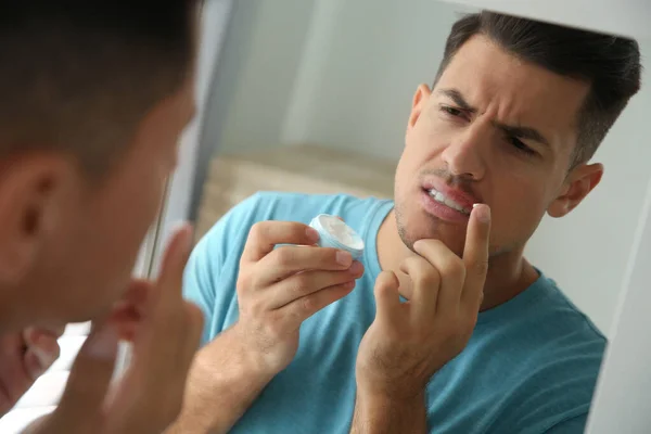 Homem Com Herpes Aplicando Creme Nos Lábios Frente Espelho Casa — Fotografia de Stock