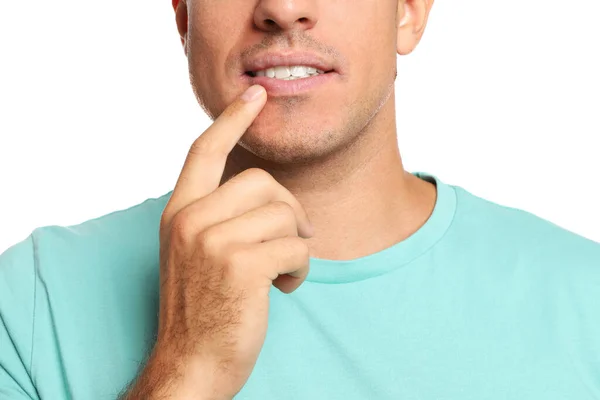 Άνδρας Έρπη Αγγίζοντας Χείλη Λευκό Φόντο Closeup — Φωτογραφία Αρχείου