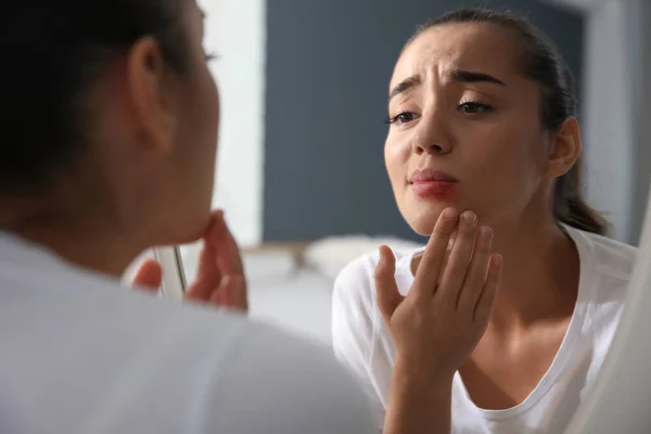 Young Woman Herpes Lip Looking Mirror Home — Stock Photo, Image