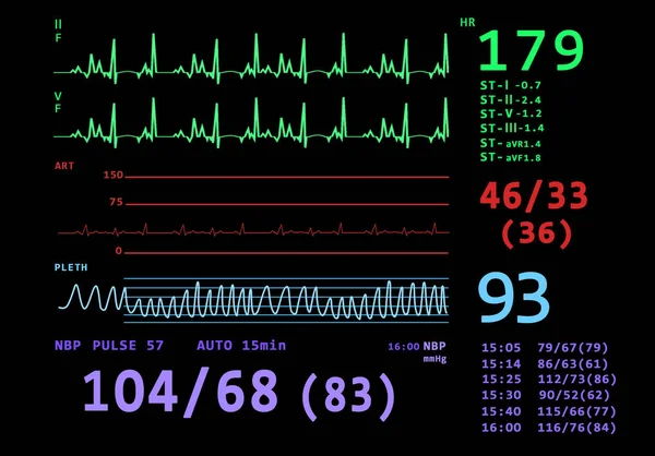 Kardiogram Adatok Pulzusmérő Kijelzőjén Illusztráció — Stock Fotó