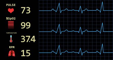 Kalp atış hızı monitöründe kardiyogram ve veri. Görüntü