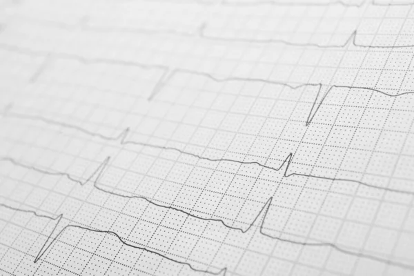 Informe Cardiografía Como Antecedentes Vista Cerca Diagnóstico Cardíaco — Foto de Stock