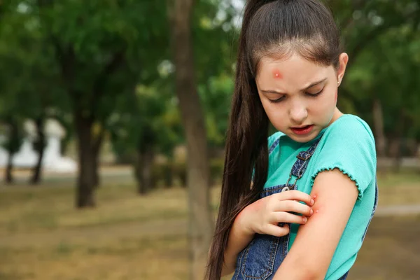 Ragazza Graffiare Braccio Con Punture Insetti Nel Parco Spazio Testo — Foto Stock