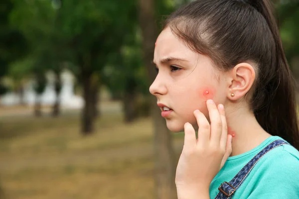 Ragazza Toccando Guancia Con Morso Insetto Nel Parco Spazio Testo — Foto Stock