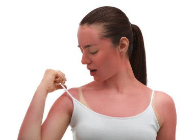 Woman with sunburned skin on white background clipart