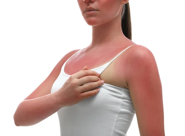 Γυναίκα Ηλιοκαμένο Δέρμα Λευκό Φόντο Κοντινό Πλάνο — Φωτογραφία Αρχείου