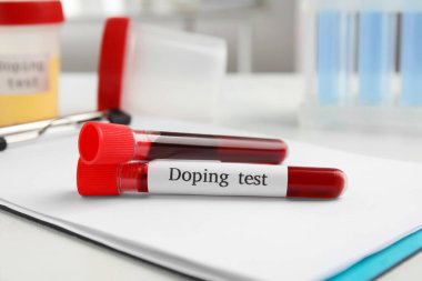Üzerinde kan örnekleri olan test tüpleri. Doping kontrolü