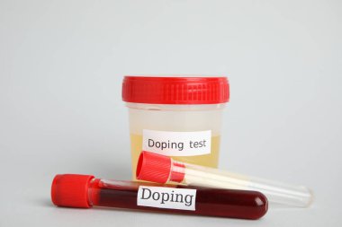 Açık gri arka planda örnekleri olan kavanoz ve test tüpleri. Doping kontrolü