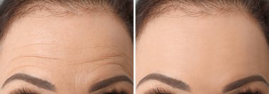 Biyolojik evrim öncesi ve sonrası olgun kadın fotoğraflarıyla kolaj, yakın çekim