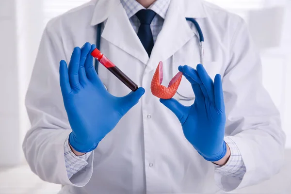 Лікар Тримає Модель Щитовидної Залози Зразки Крові Приміщенні Крупним Планом — стокове фото