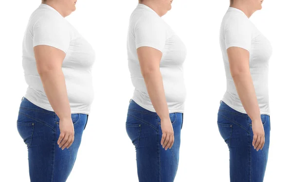 Frau Vor Und Nach Gewichtsverlust Auf Weißem Hintergrund Collage — Stockfoto