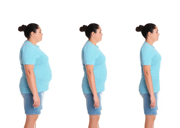 Mujer Antes Después Pérdida Peso Sobre Fondo Blanco Collage — Foto de Stock