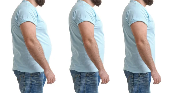 Mann Vor Und Nach Gewichtsverlust Auf Weißem Hintergrund Collage — Stockfoto