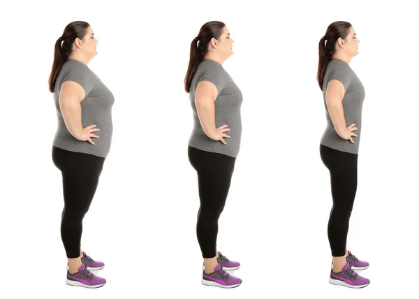 Frau Vor Und Nach Gewichtsverlust Auf Weißem Hintergrund Collage — Stockfoto
