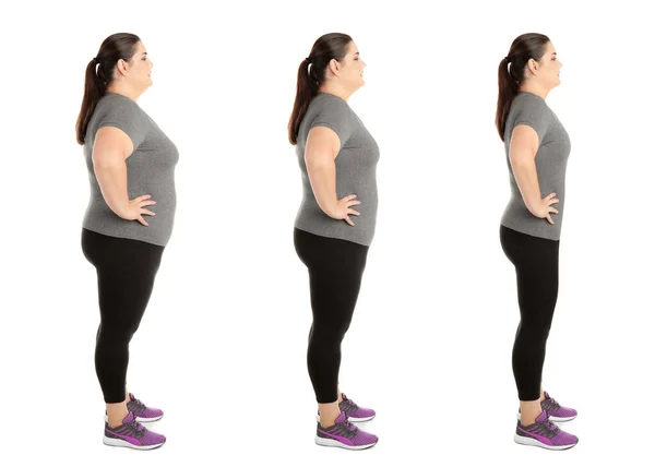 Mujer Antes Después Pérdida Peso Sobre Fondo Blanco Collage — Foto de Stock