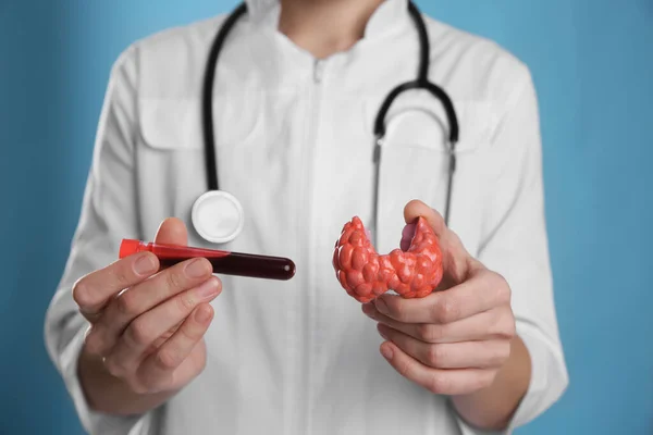 Médico Sosteniendo Modelo Plástico Tiroides Afectada Muestra Sangre Sobre Fondo — Foto de Stock