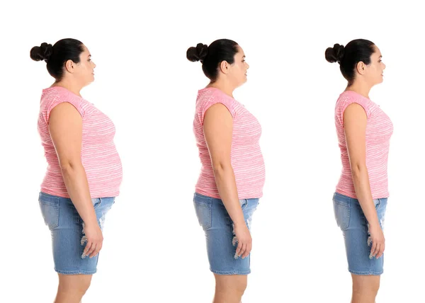 Mujer Antes Después Pérdida Peso Sobre Fondo Blanco Collage — Foto de Stock