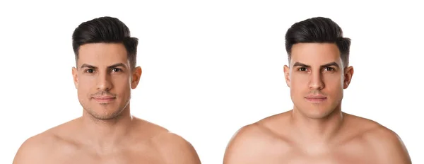 Colagem Com Fotos Homem Bonito Antes Depois Fazer Barba Fundo — Fotografia de Stock