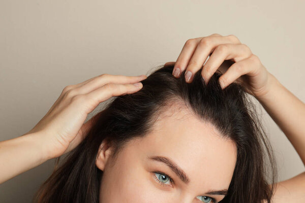Woman suffering from baldness on grey background, closeup