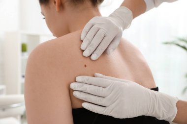 Dermatolog klinikte hastanın doğum lekesini inceliyor.