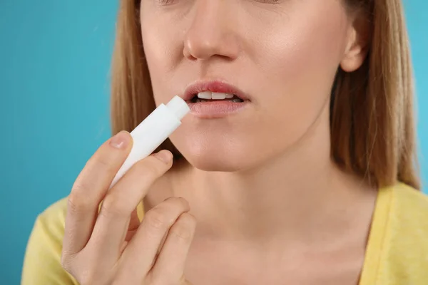 Woman Herpes Applying Lip Balm Light Blue Background Closeup — Zdjęcie stockowe