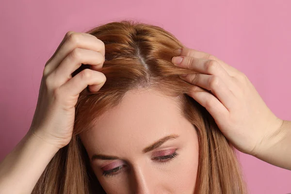 Frau Mit Glatze Auf Rosa Hintergrund Nahaufnahme — Stockfoto